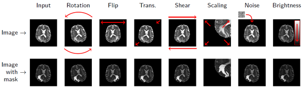 data augmentation for medical image analysis data augmentation for medical image analysis