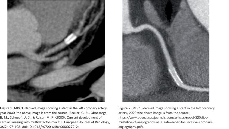 medical image of coronary arteries