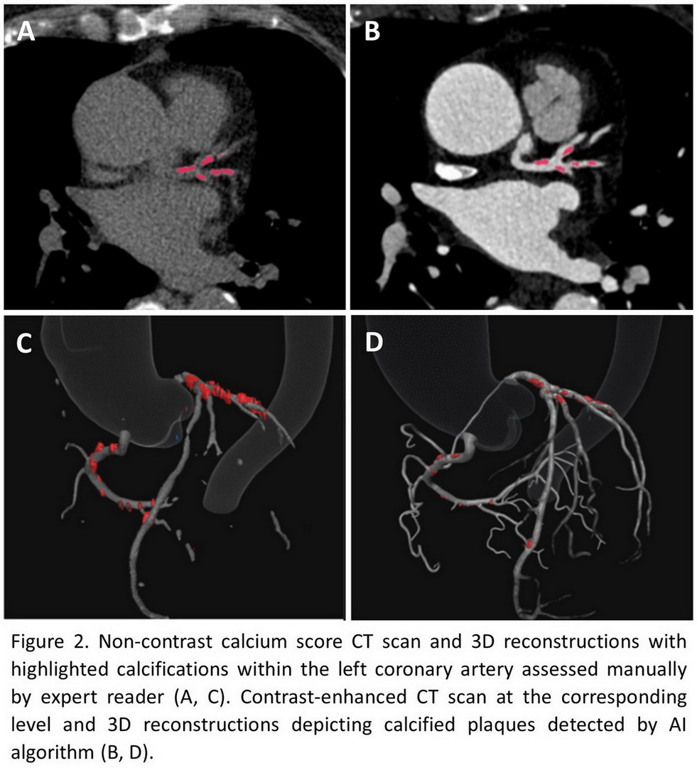 cardiovascular image analysis - 3d reconstructions