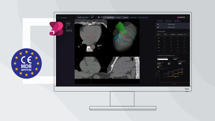 MDR Certification for two products developed by Graylight Imaging